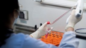 سنغافورة تبدأ تجاربها السريرية على علاج محتمل لـ”كوفيد – 19″